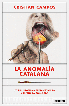 LA ANOMALIA CATALANA