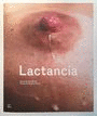 LACTANCIA